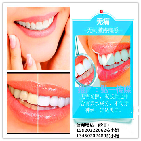 廣州國際美博會，相約薇絲頓牙齒美白納米齒雕(圖4)