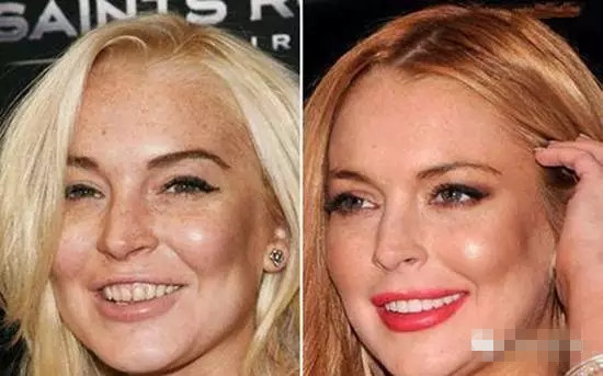 廣州國際美博會，相約薇絲頓牙齒美白納米齒雕(圖6)